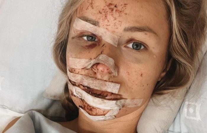 “Miracle” – influencer survives horror crash in Namibia