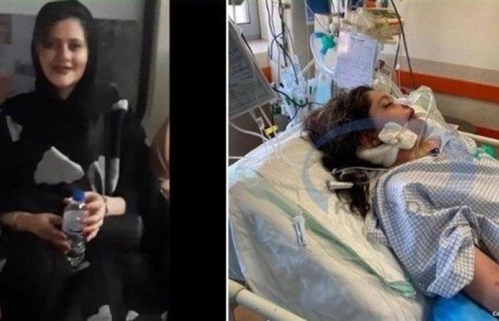 Iran describes the “Mahsa Amini” incident as unfortunate…and medical photos show the assault on it