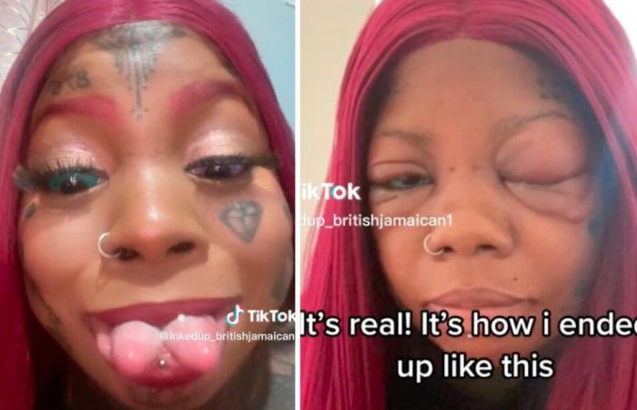 Influencer has eyes tattooed and is almost blind – today she would do one thing differently